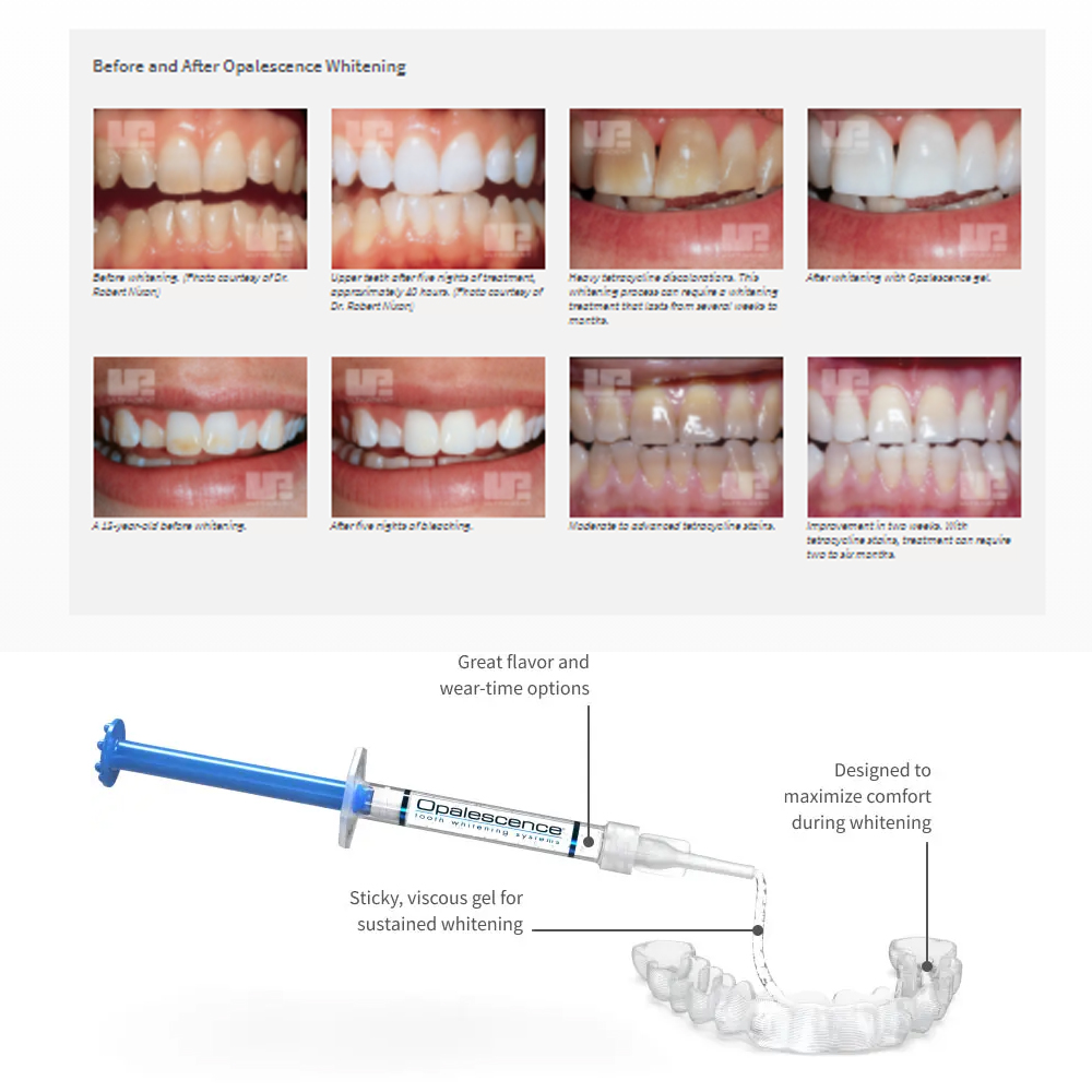 Opalescence Whitening 20% PF 2 - Teeth Whitening Hydrogen Peroxide recension och pris