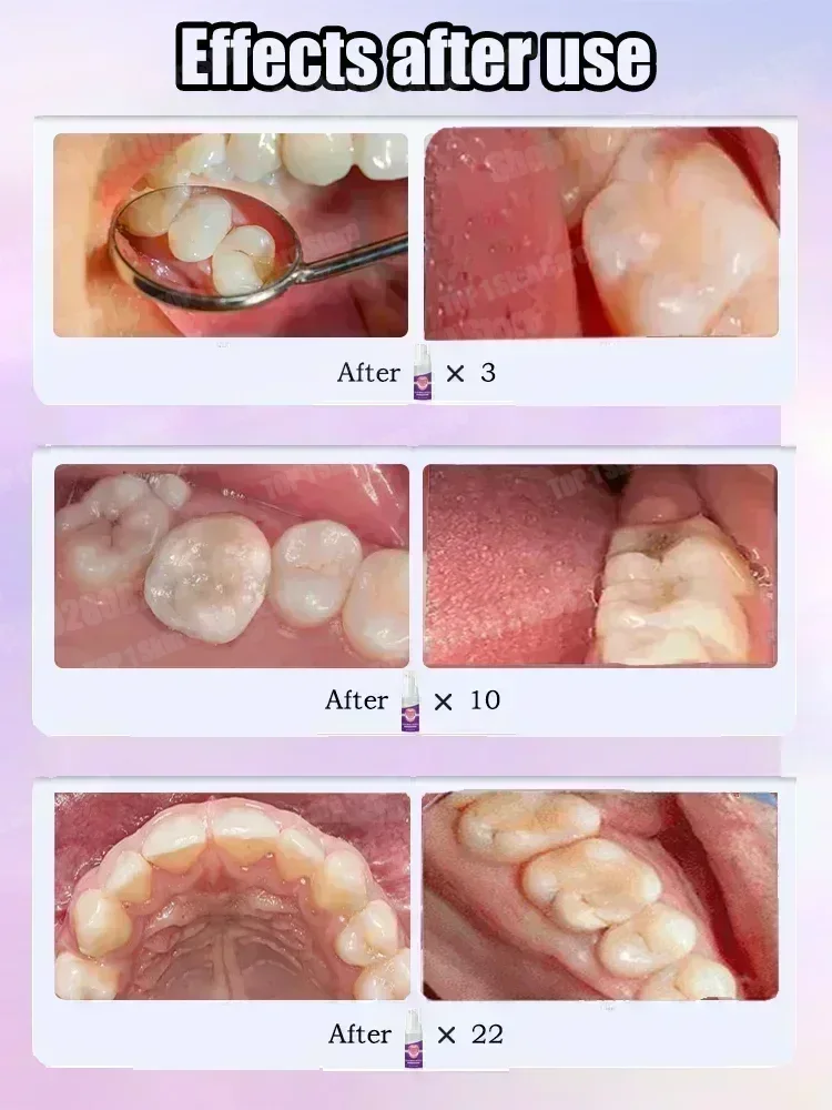 Hot sales Best-selling, Scient - Teeth Whitening Cream recension och pris