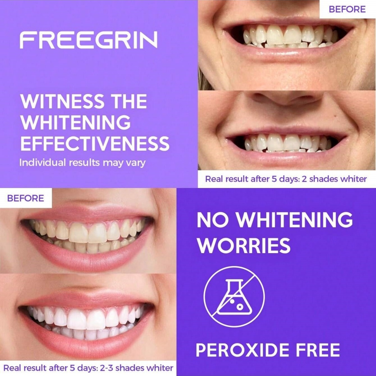 Deluxe Whitening Teeth Sticker - Teeth Whitening Hydrogen Peroxide recension och pris