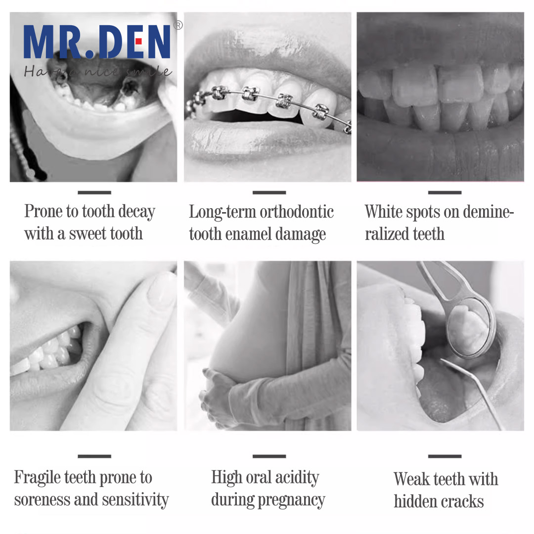 Japan GC Fluoride Enhanced Den - Teeth Whitening In Japan recension och pris